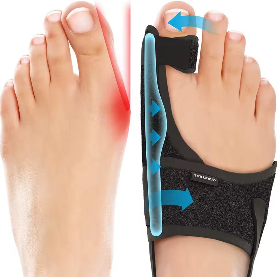 Night Splint for Big Toe Alignment – Adjustable Orthotic Support
